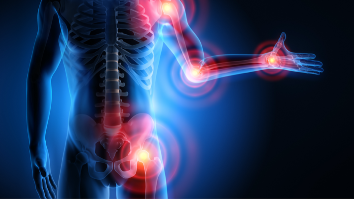 Cómo el ejercicio físico puede aliviar los síntomas de la fibromialgia